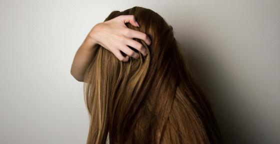 Alopecia